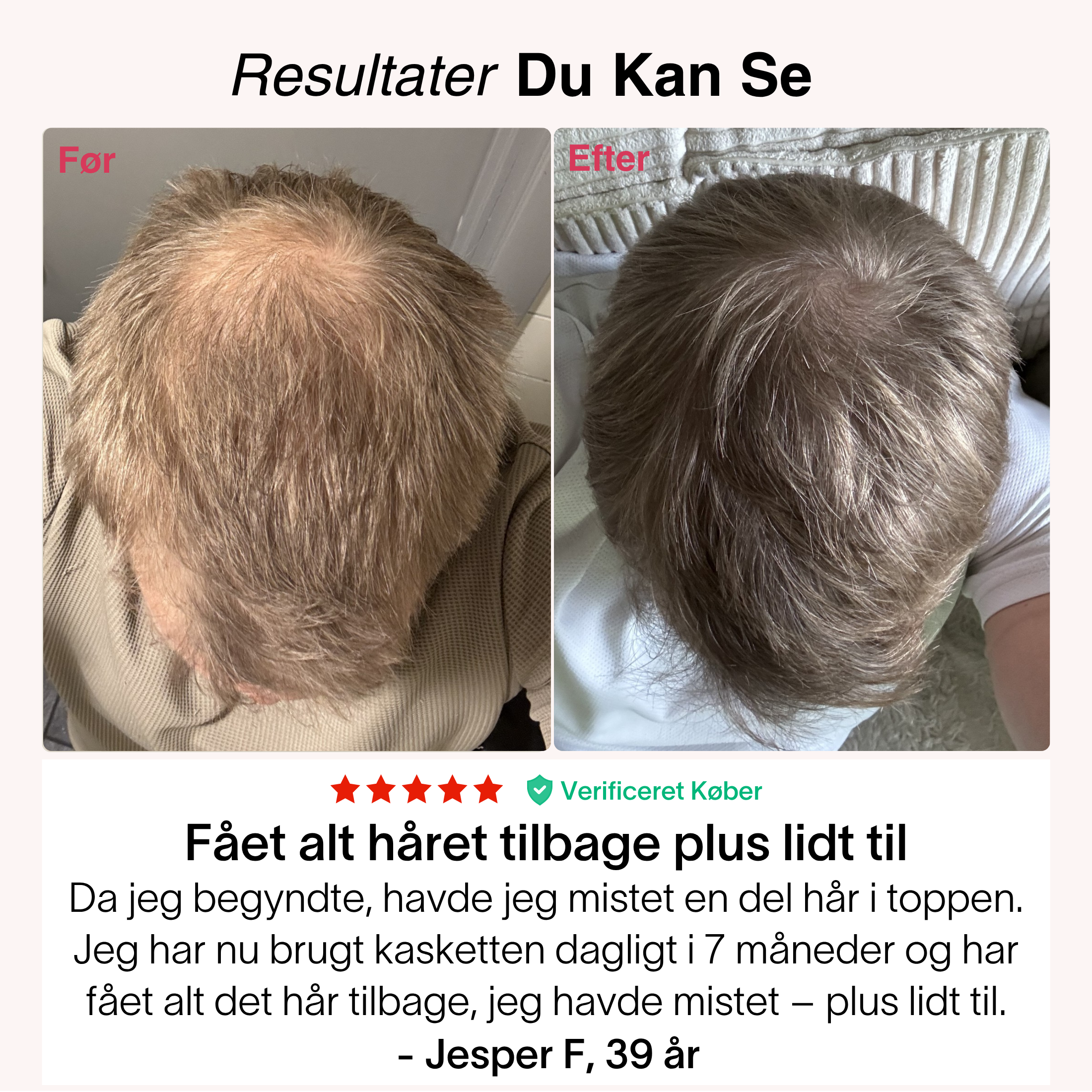 Rødlys-Kasketten®