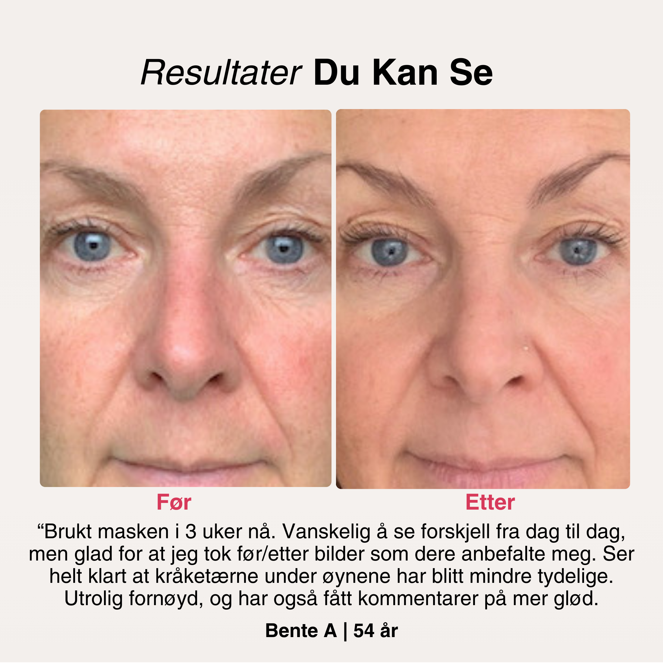AntiAge-Masken® – 7