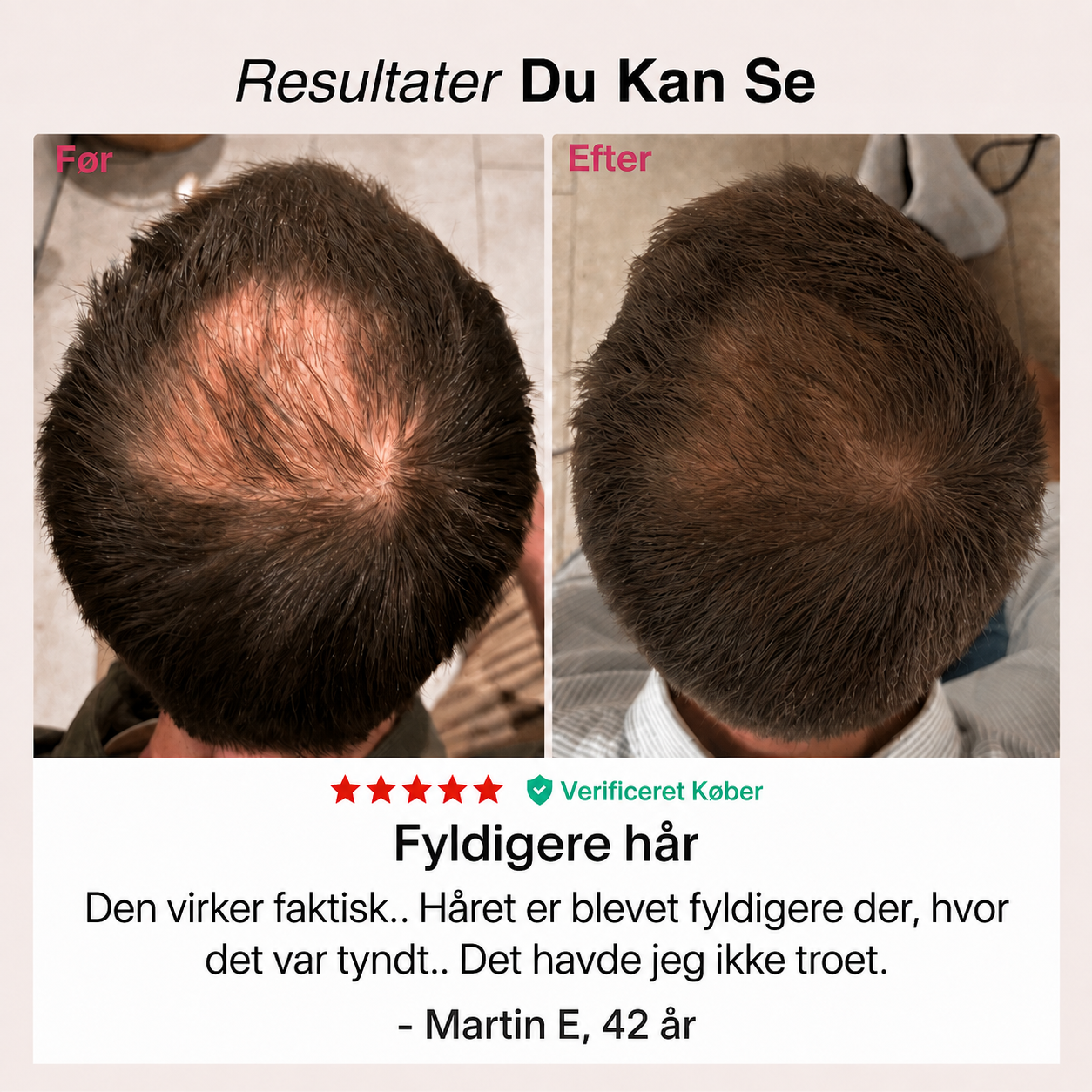 Rødlys-Kasketten®