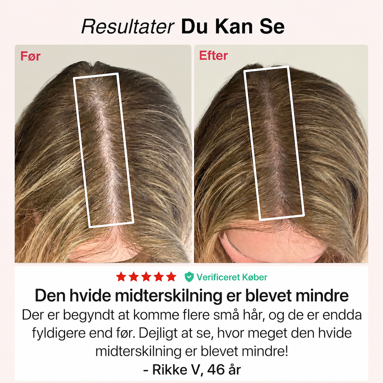 Rødlys-Kasketten®