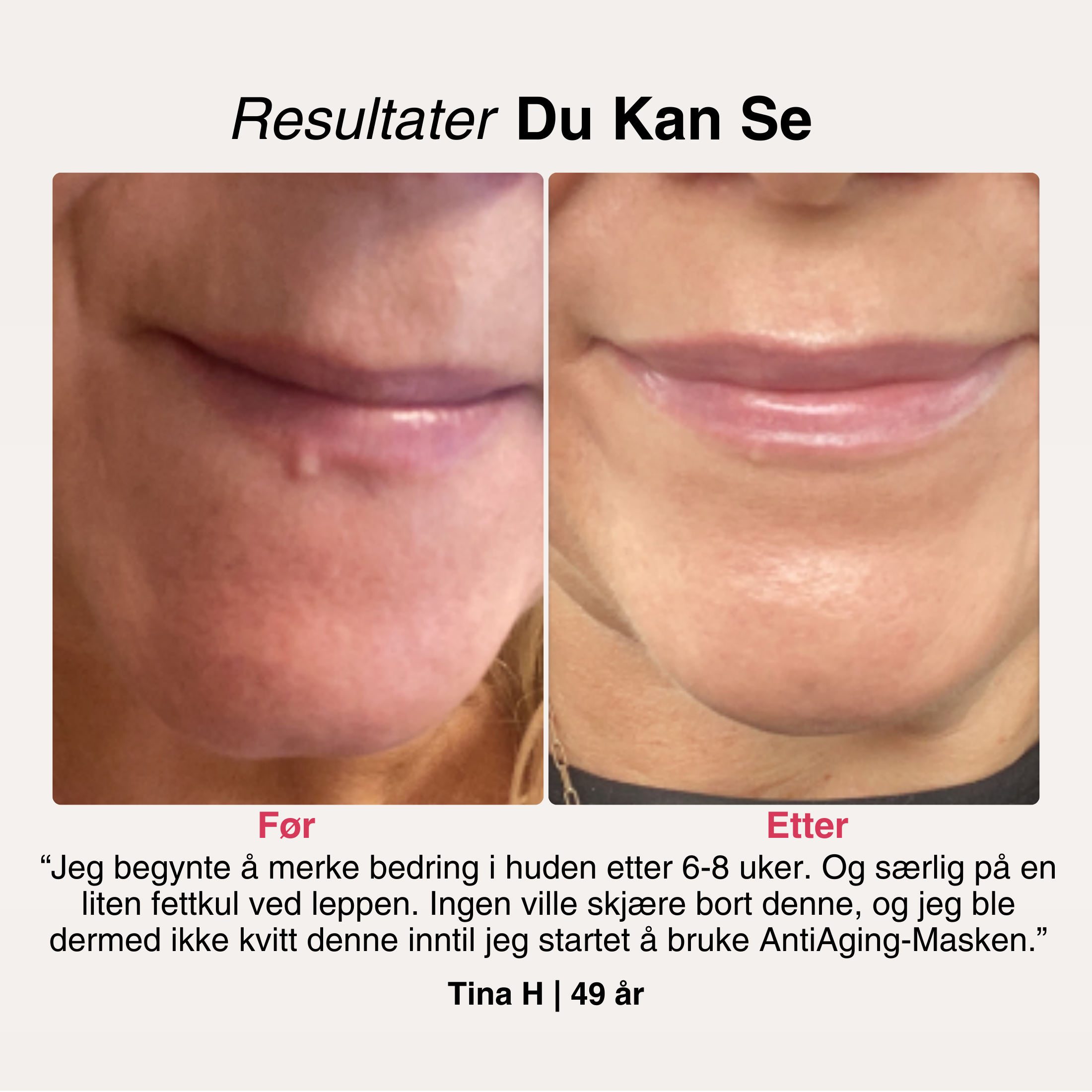 AntiAge-Masken® – 6