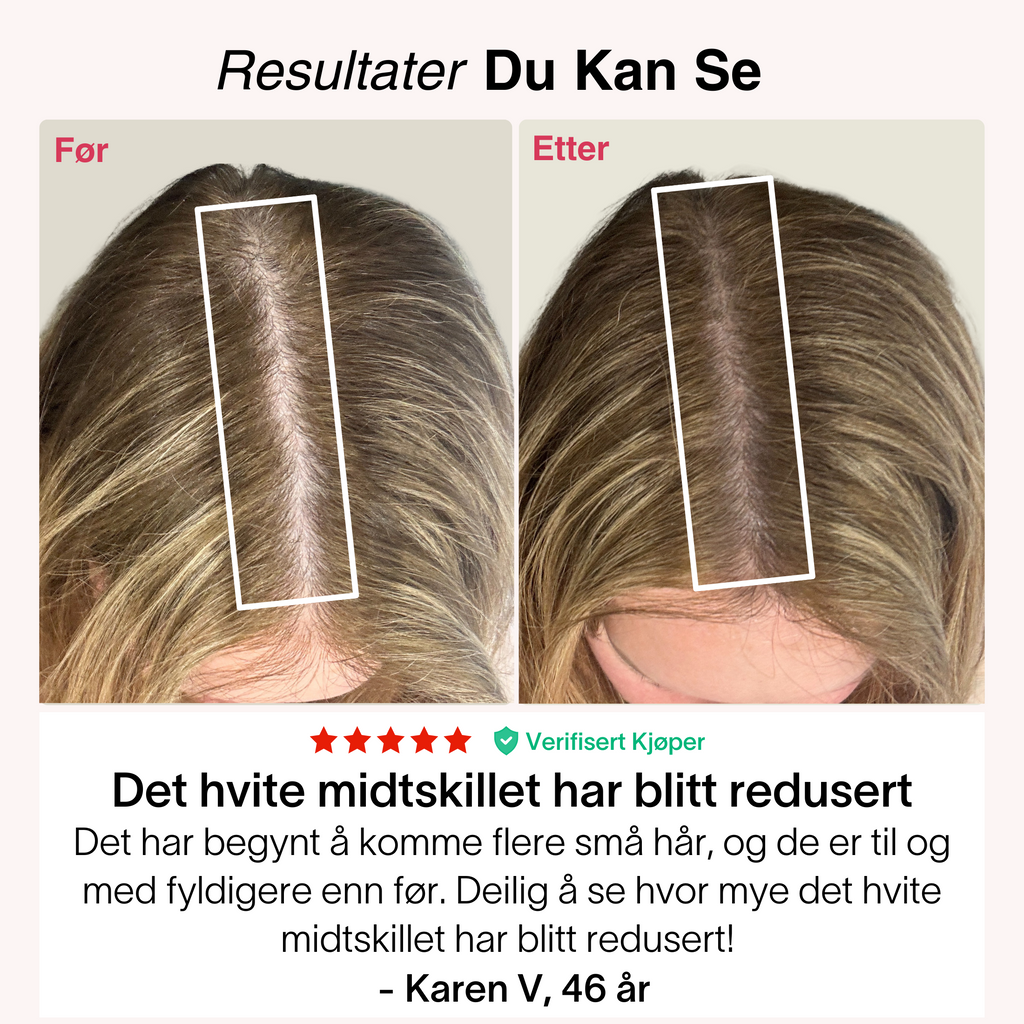 Rødlys-Kasketten®