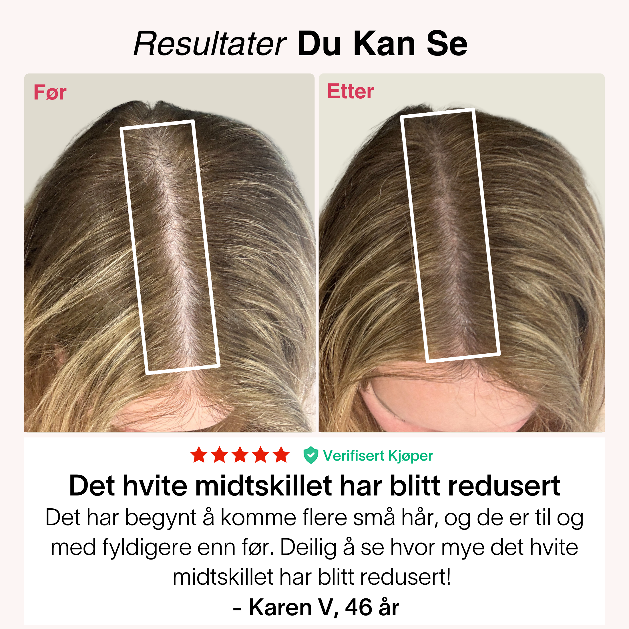 Rødlys-Kasketten®