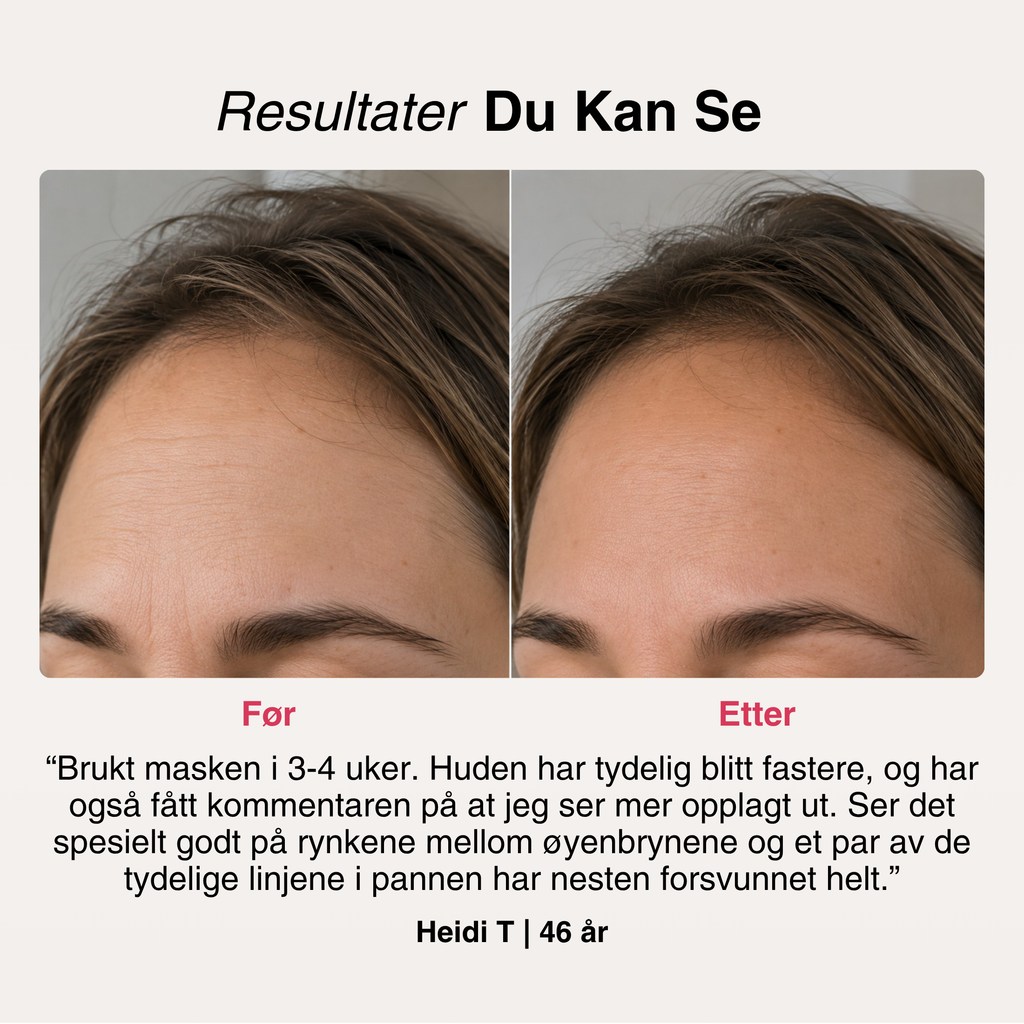 SoftSkin InfraLight® LED-maske