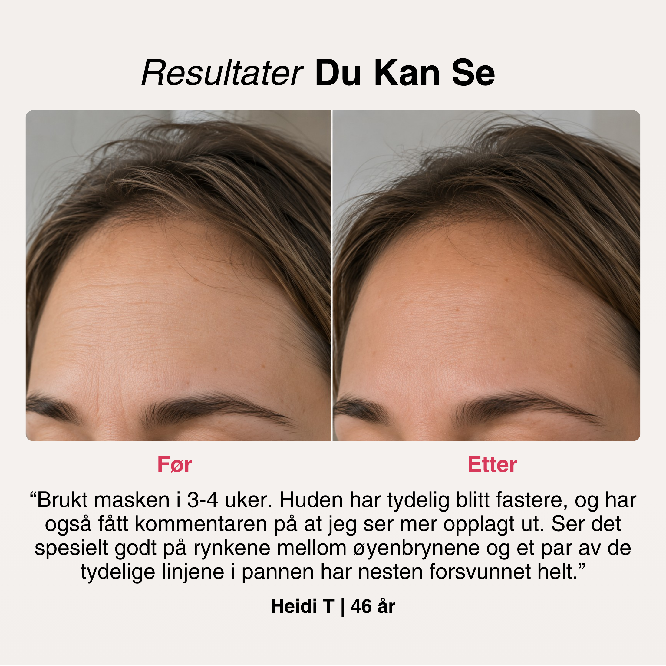 SoftSkin InfraLight® LED-maske