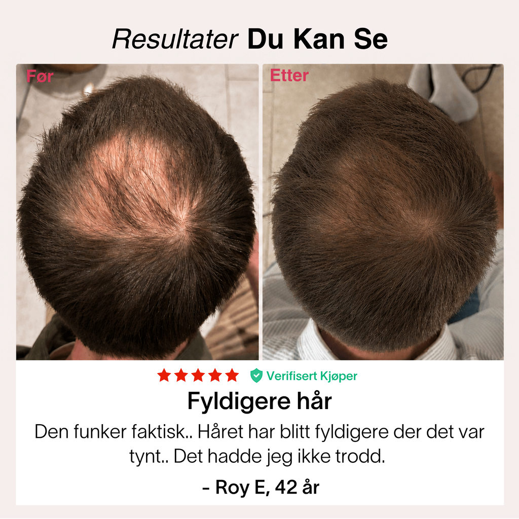 Rødlys-Kasketten®