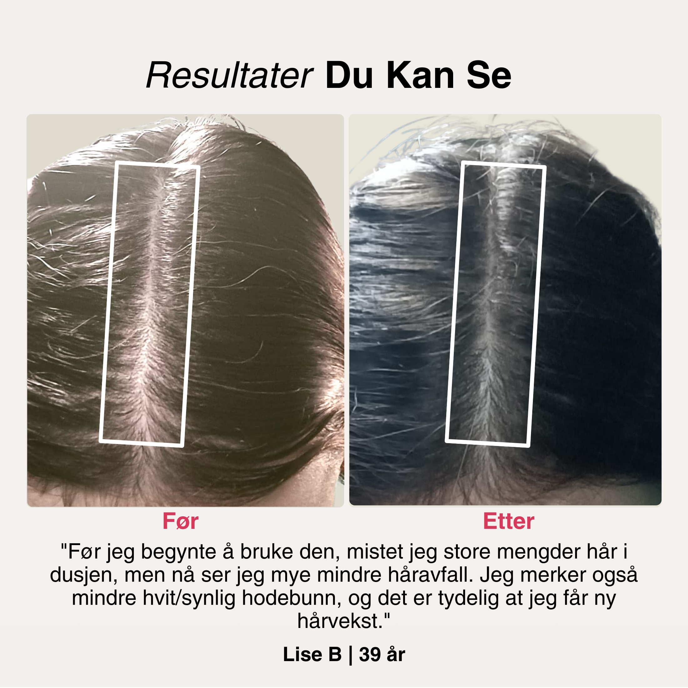 Rødlys-Kasketten
