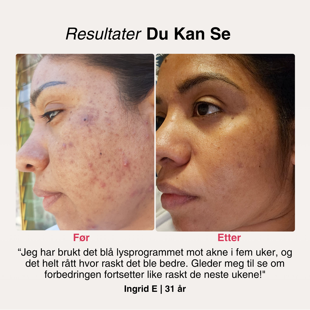 SoftSkin InfraLight LED-maske